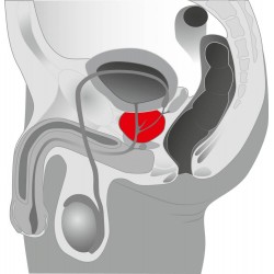 Prostatavibrator »O-Boy«, 10,5 cm, mit Reiznoppen