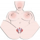 Intimate Spreader